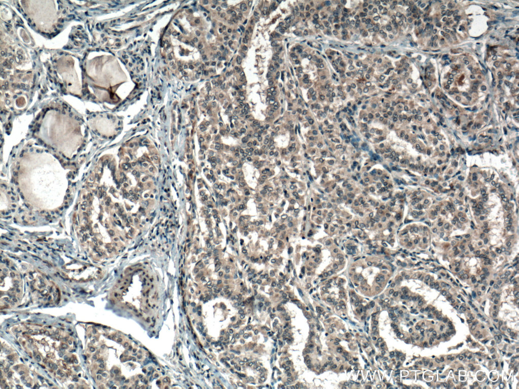 SLC24A5 Polyclonal antibody