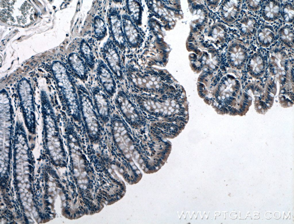 GET4 Polyclonal antibody