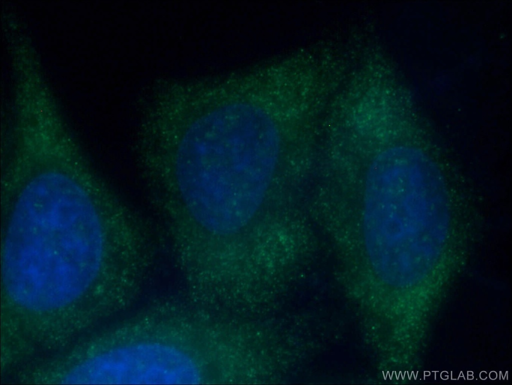 YTHDC2 Polyclonal antibody