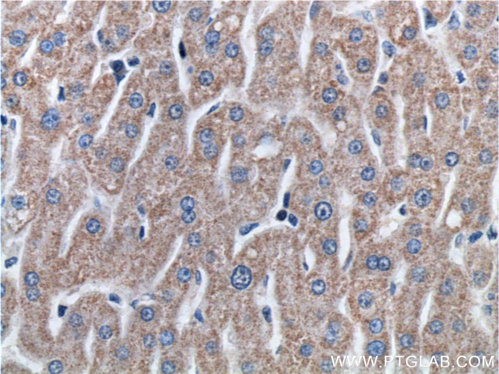ETHE1 Polyclonal antibody