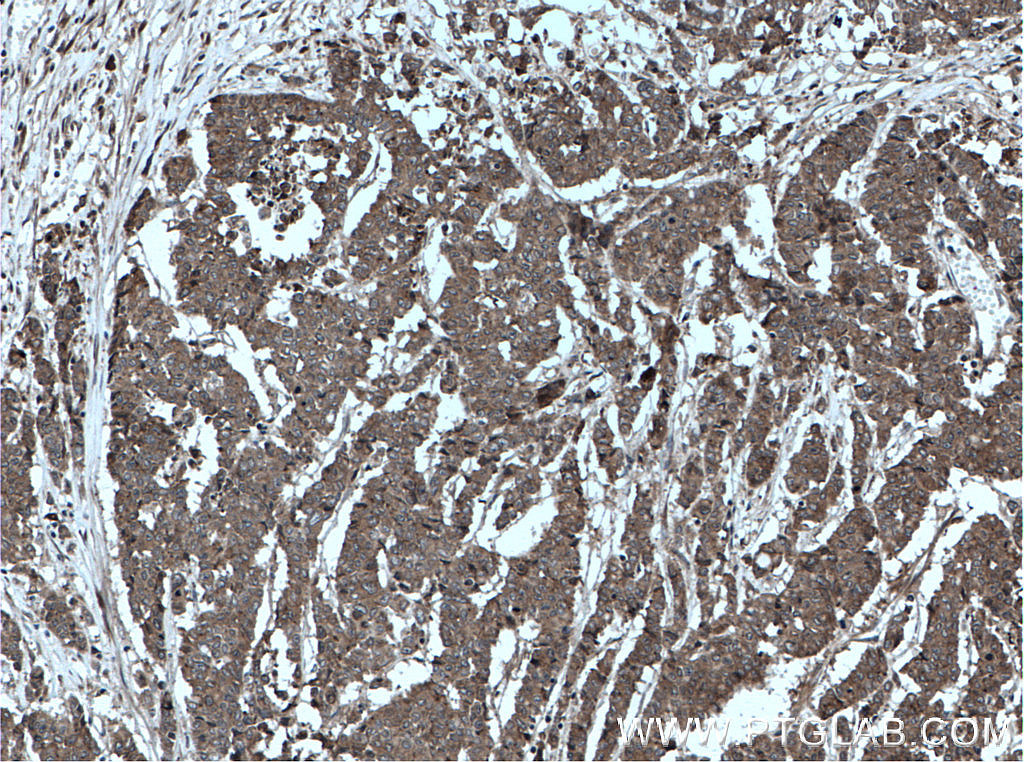 OSM Polyclonal antibody
