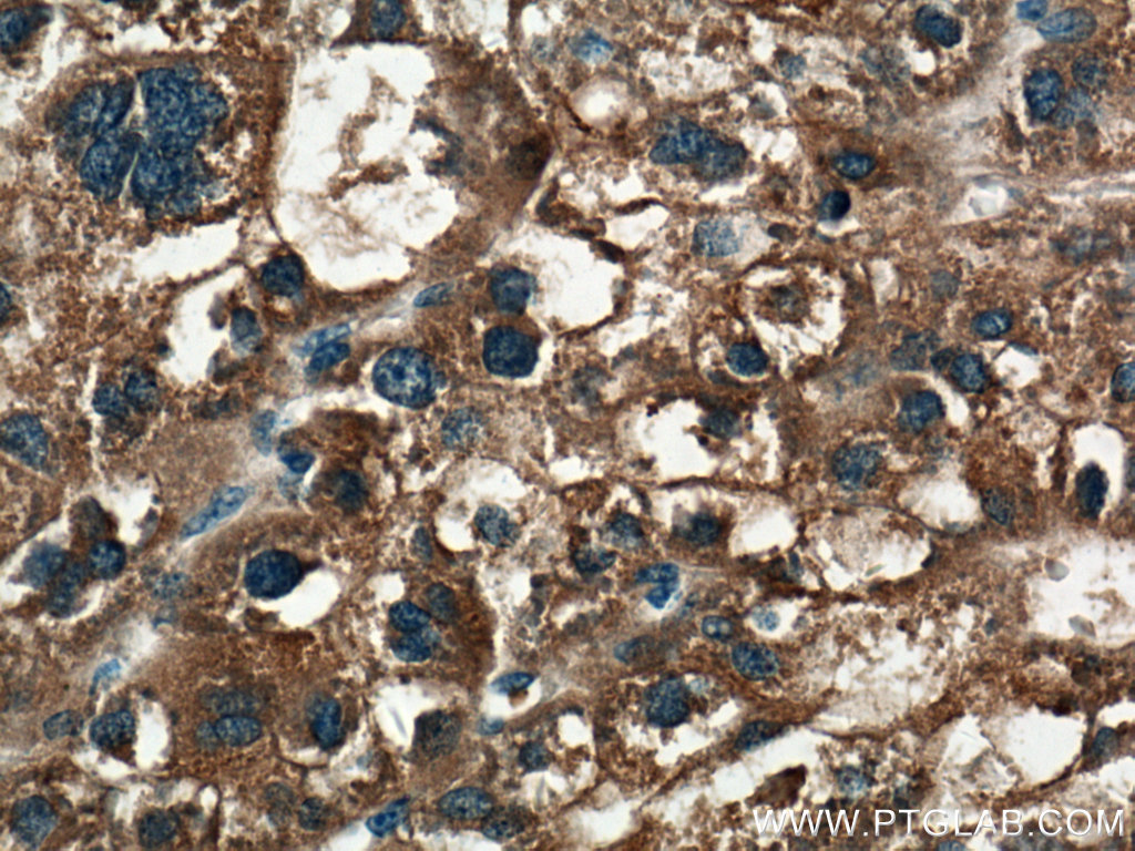 PPP4R1 Polyclonal antibody