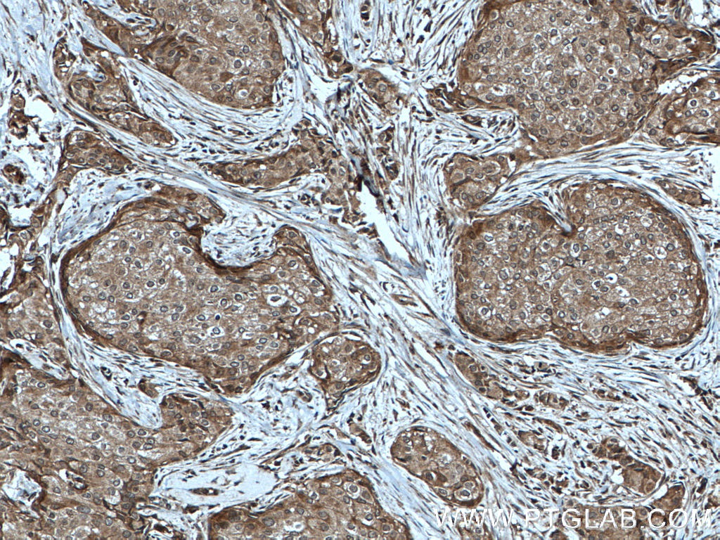 PARG Polyclonal antibody