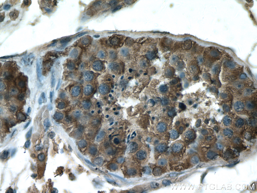 GDPD1 Polyclonal antibody