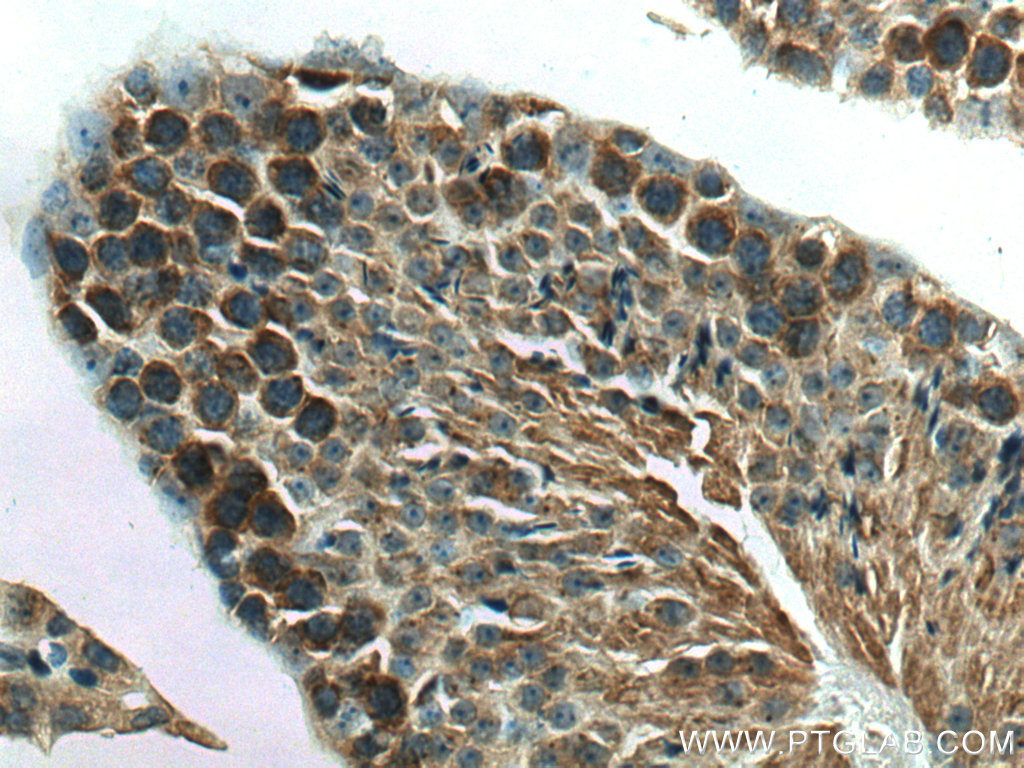 NEU3 Polyclonal antibody