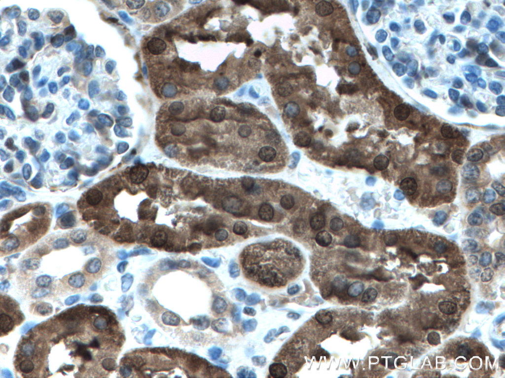 PBLD Polyclonal antibody