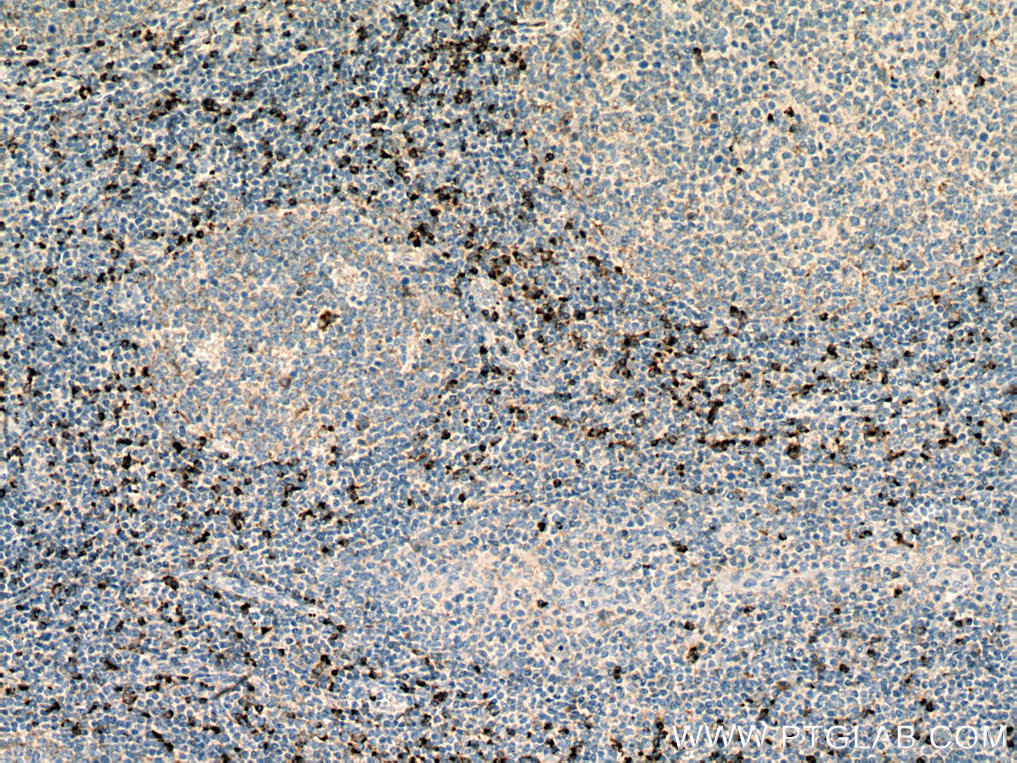 Granzyme K Polyclonal antibody