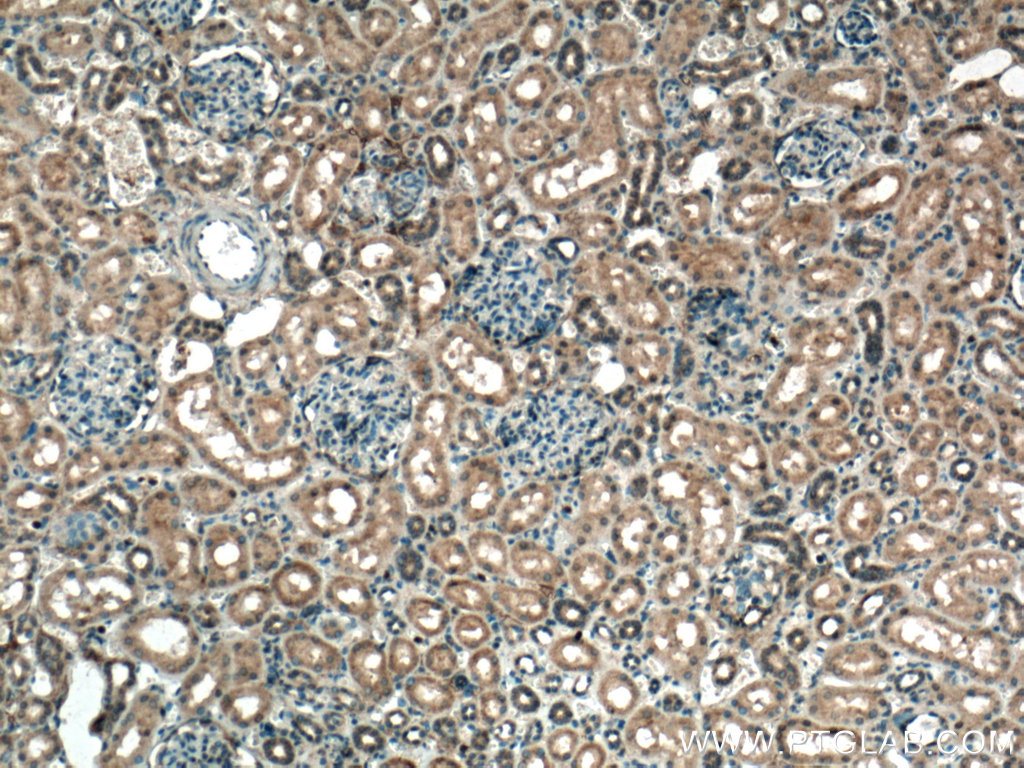 C1orf35 Polyclonal antibody