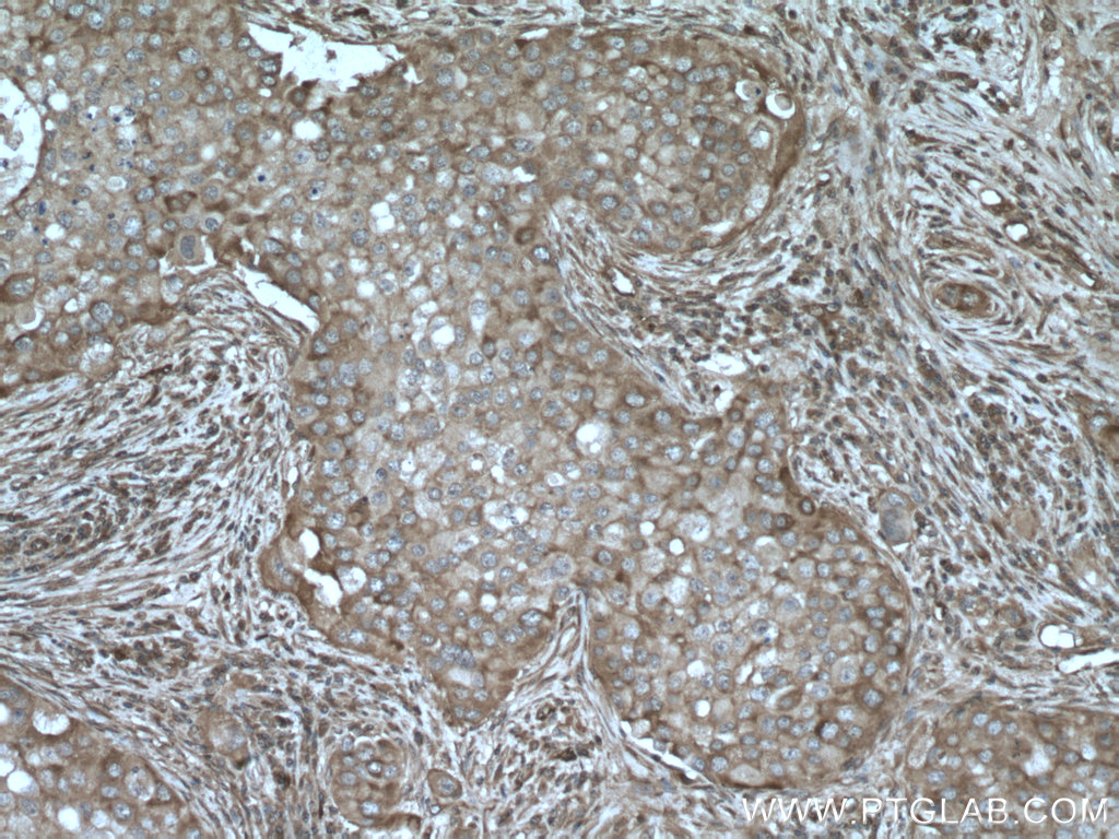 AKAP13 Polyclonal antibody