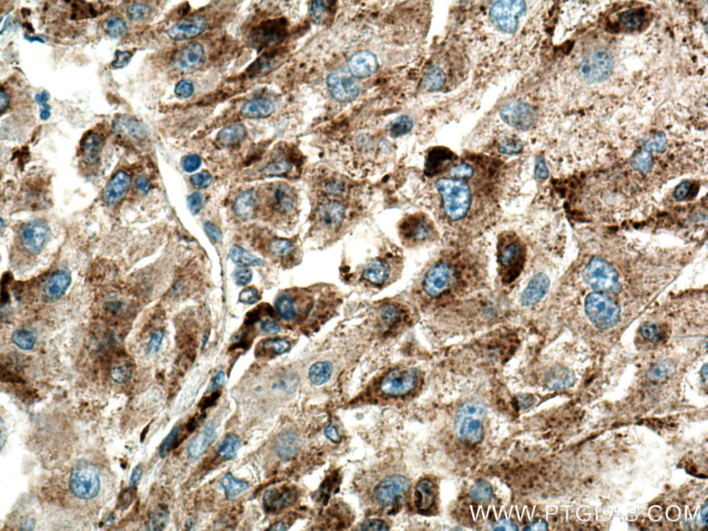 Cathepsin L Polyclonal antibody