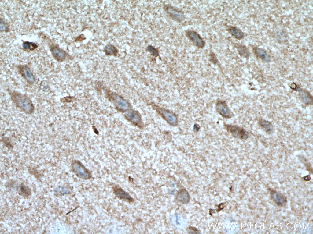 GBA Polyclonal antibody