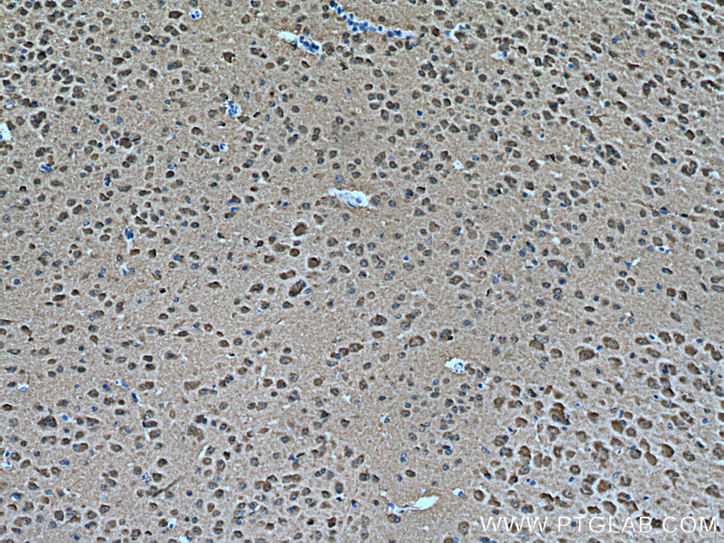 MAPK8/9/10 Polyclonal antibody