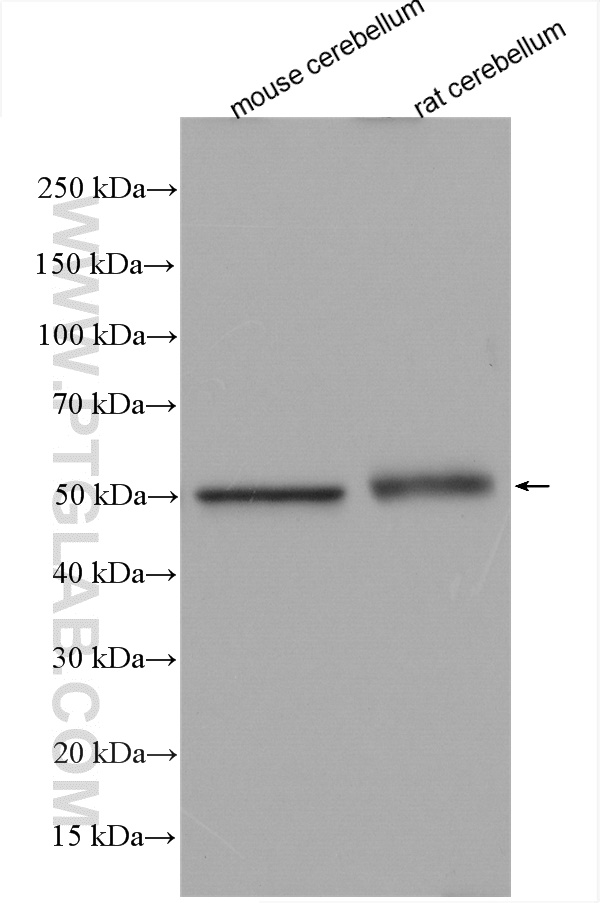 TUBG2 Polyclonal antibody