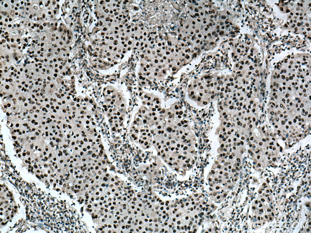 BPTF Polyclonal antibody