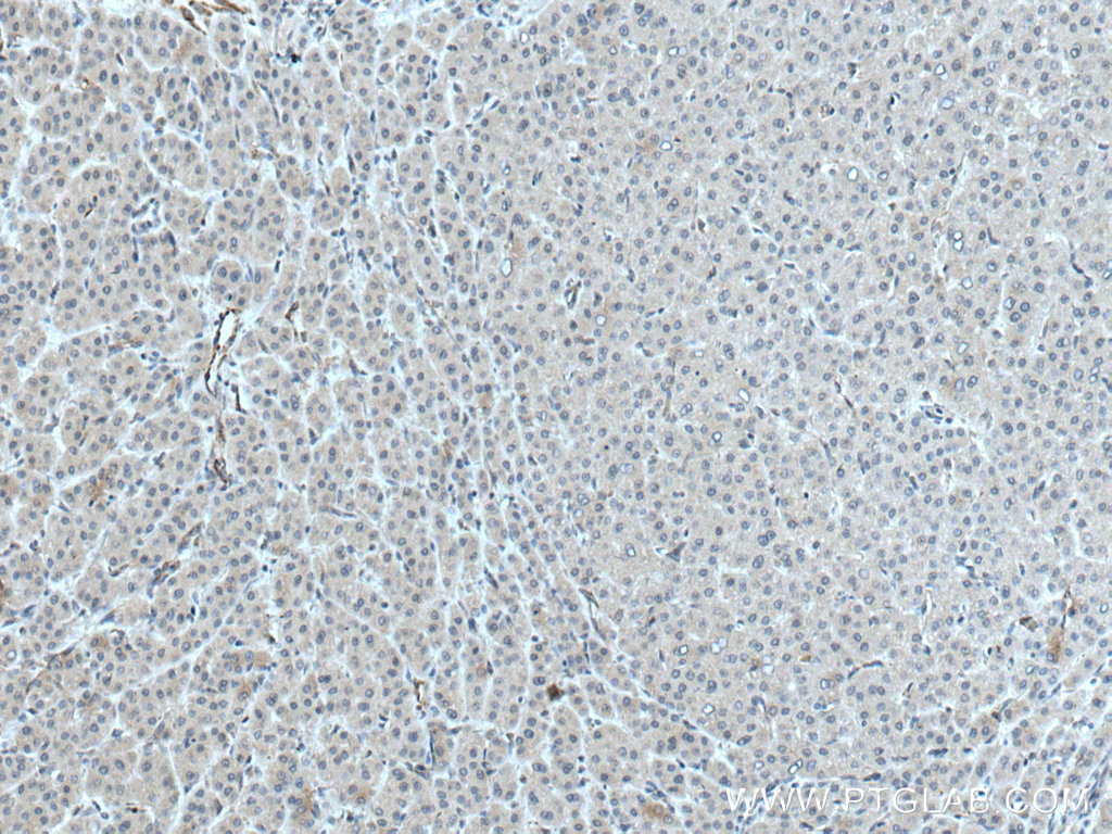 ATG14 Polyclonal antibody