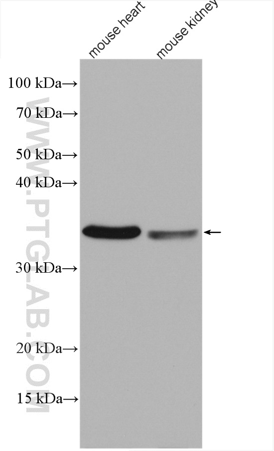 COQ3 Polyclonal antibody