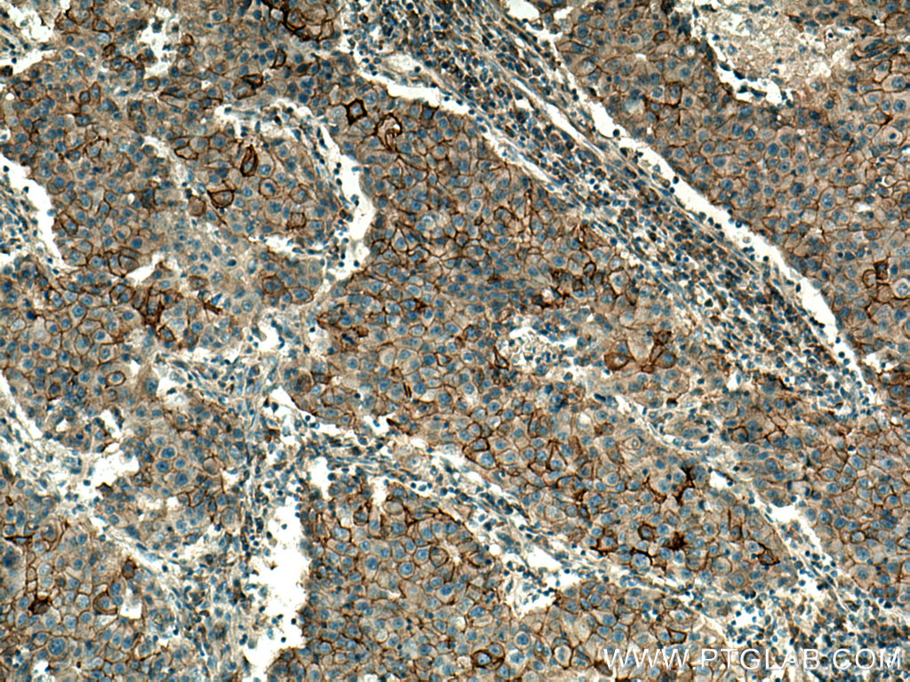 SLC12A2 Polyclonal antibody