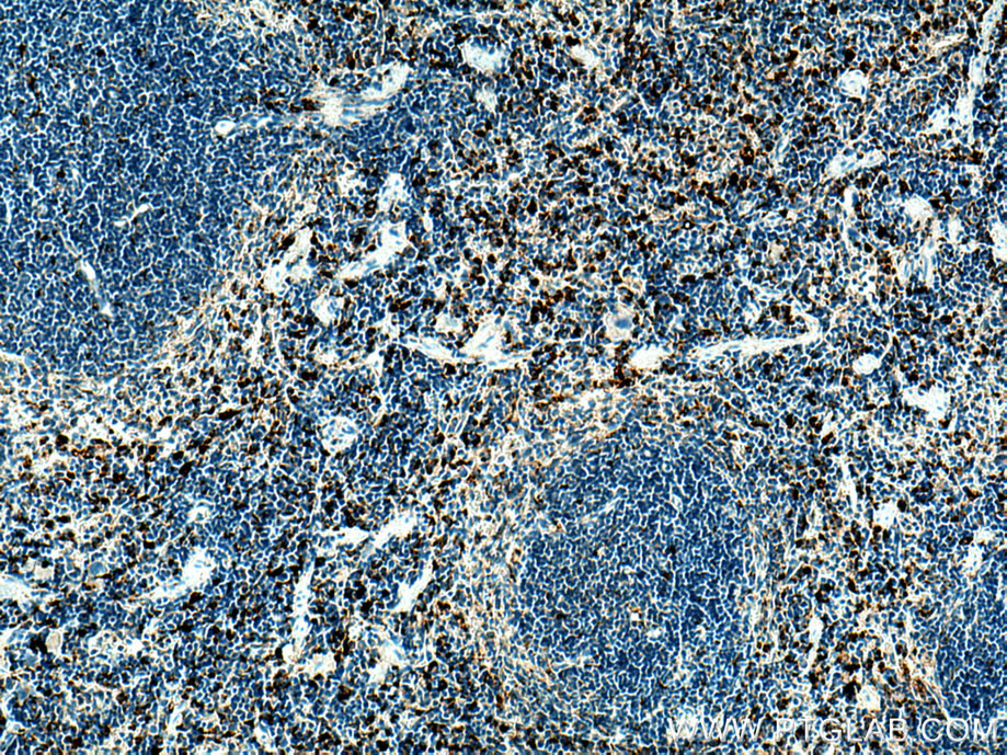 Cd68 Polyclonal antibody