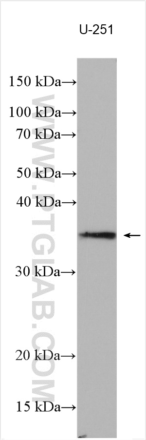 SEC22C Polyclonal antibody