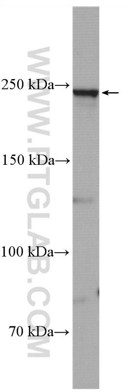 SCN1A Polyclonal antibody