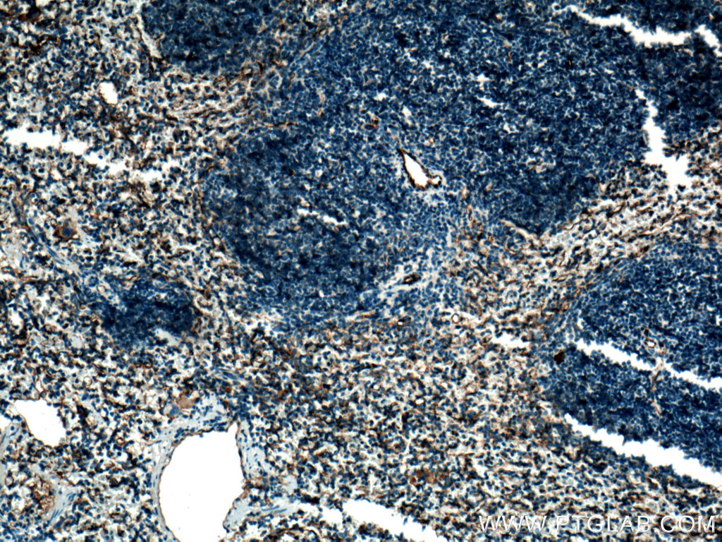 Cd31 Polyclonal antibody