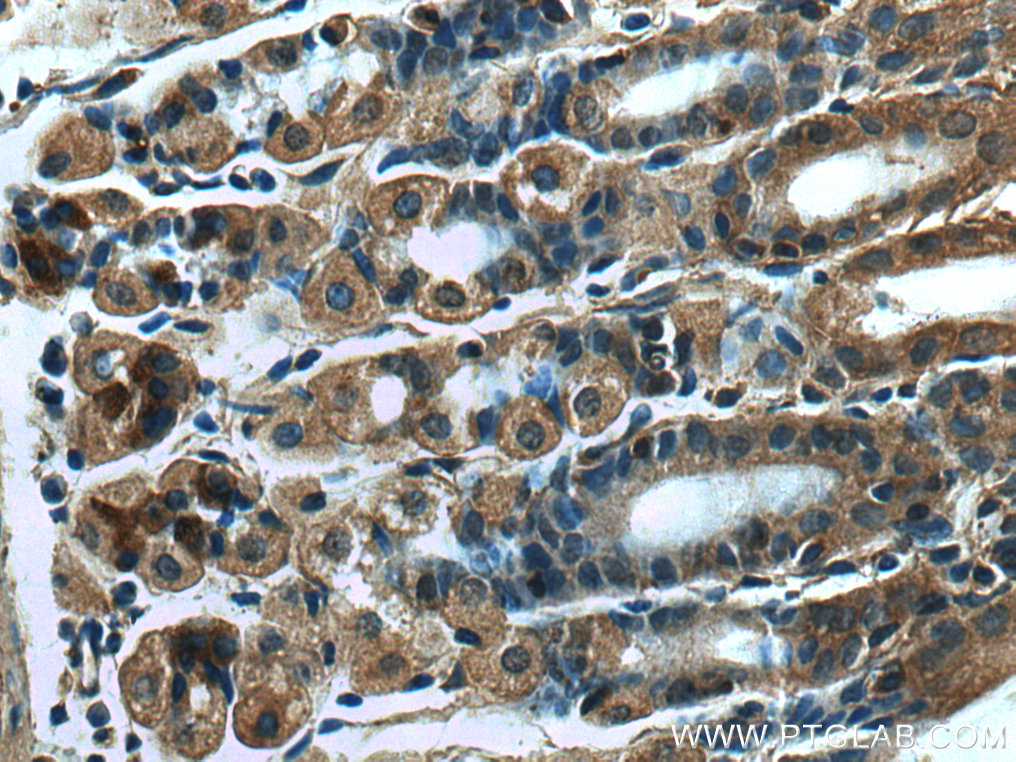 RSAD2 Polyclonal antibody