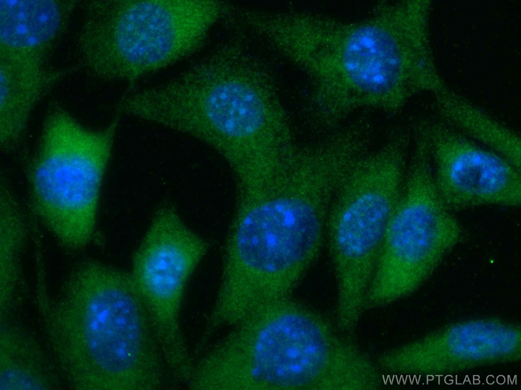 AKT2 Polyclonal antibody