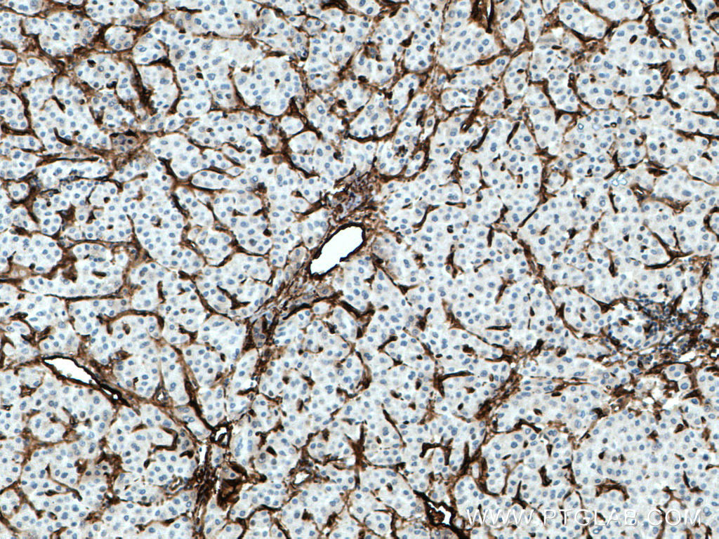 Endoglin/CD105 Polyclonal antibody