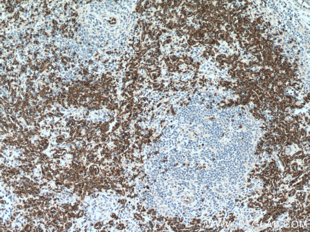 band 3/ AE1 Polyclonal antibody