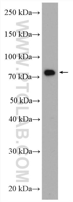 POLH Polyclonal antibody