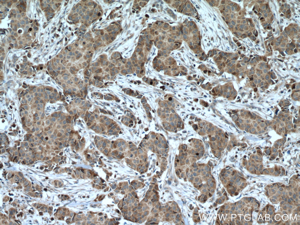 CCDC71 Polyclonal antibody