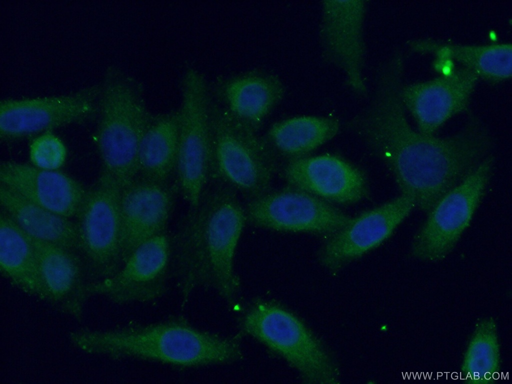 CDC123/C10orf7 Polyclonal antibody
