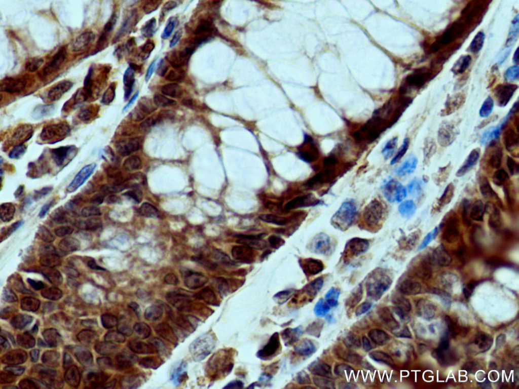FES Polyclonal antibody