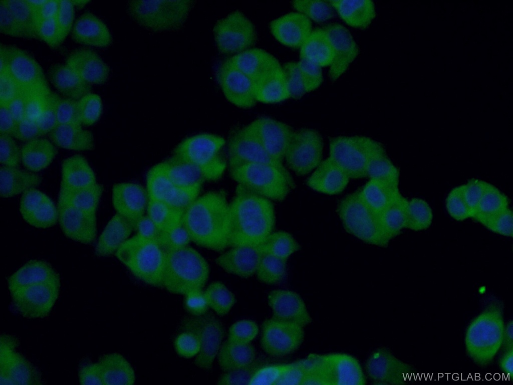 BDNF Polyclonal antibody