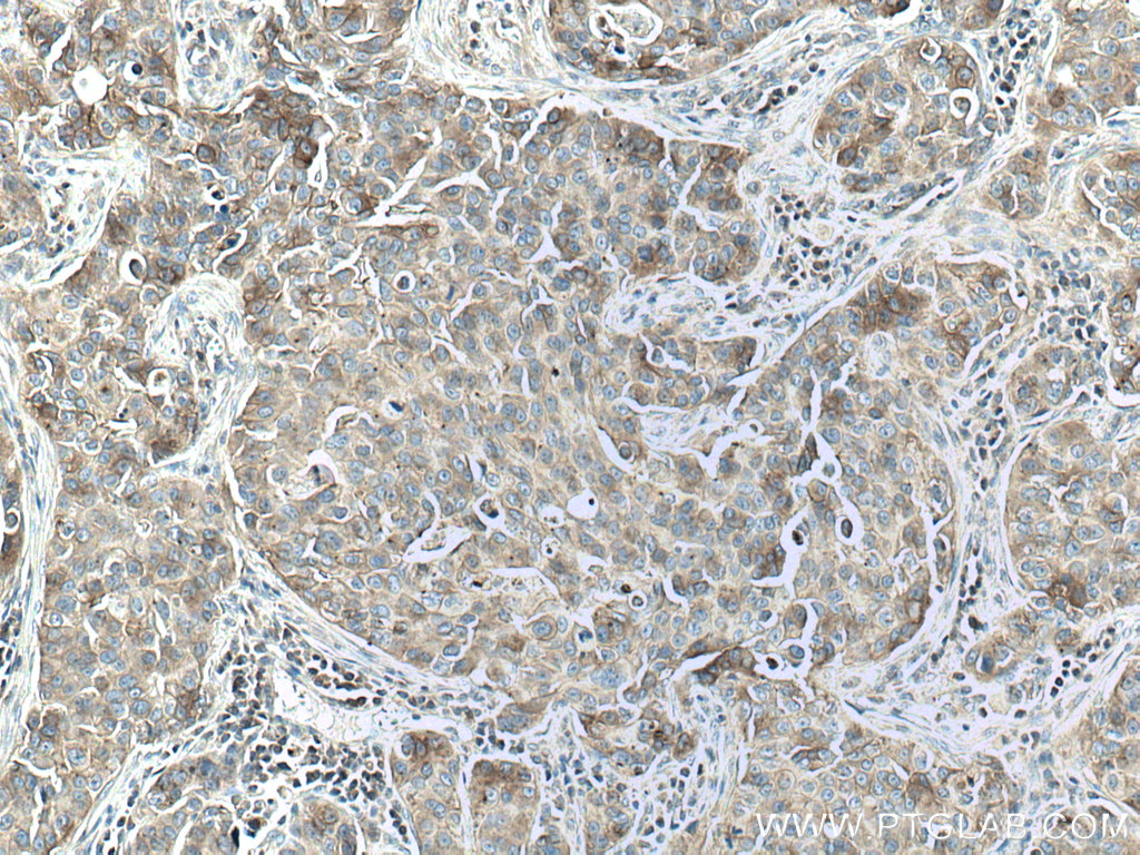 Flotillin 2 Polyclonal antibody