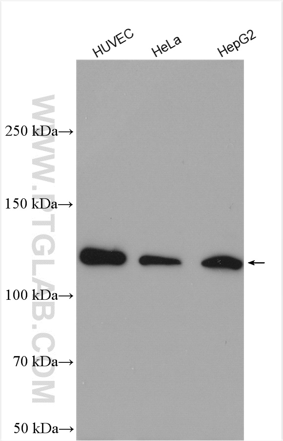 SREBF2 Polyclonal antibody