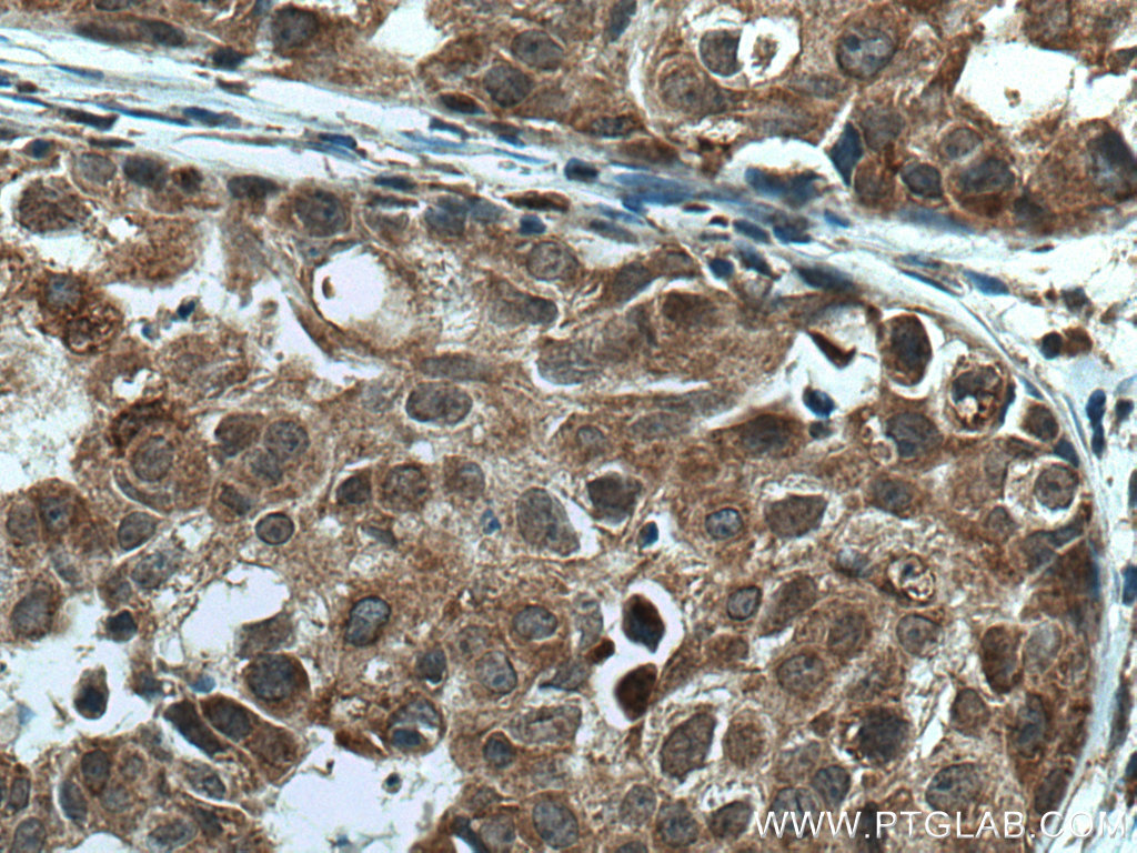 TMEM192 Polyclonal antibody