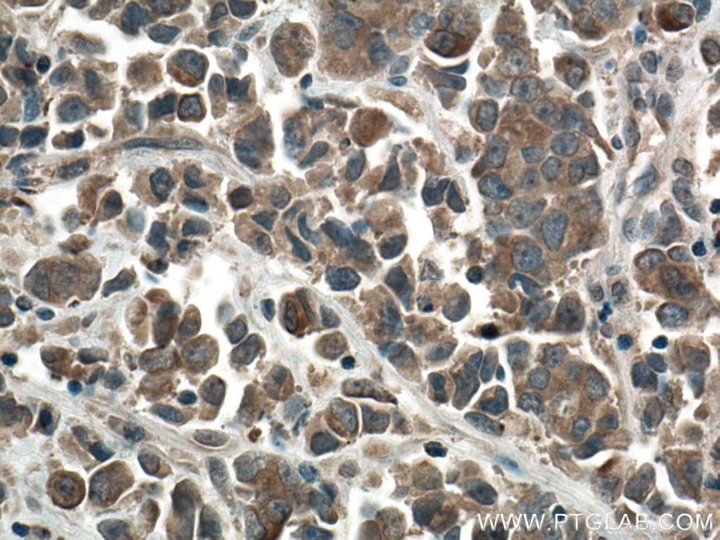 mTOR Polyclonal antibody