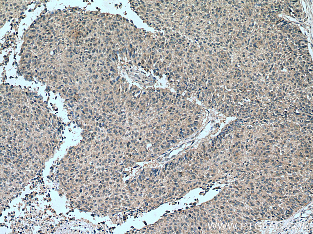 TSG101 Polyclonal antibody