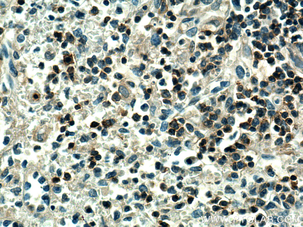 PTPRCAP Polyclonal antibody