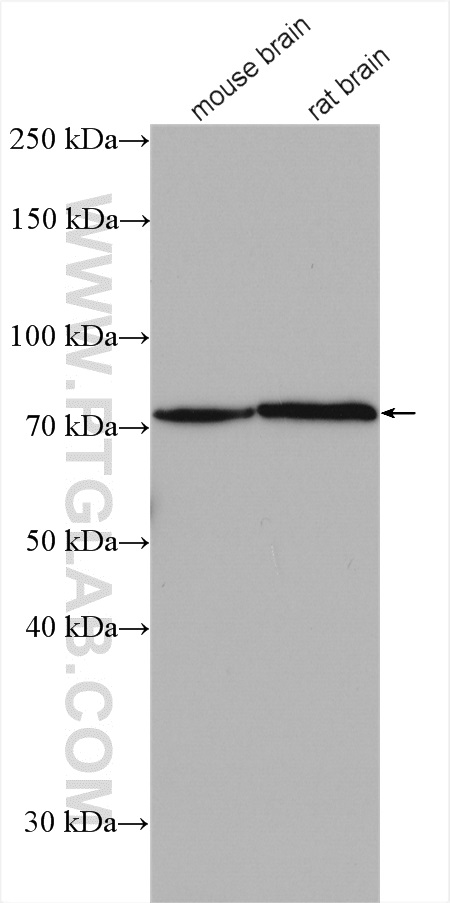 EOMES/TBR2 Polyclonal antibody