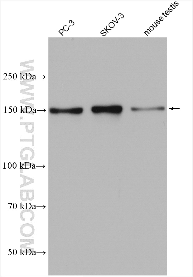 PDS5B Polyclonal antibody