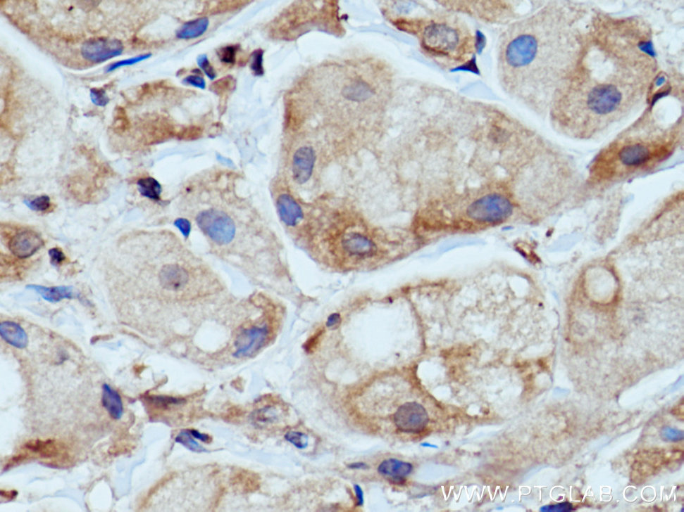 WNK1 Polyclonal antibody