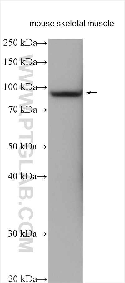 COMP Polyclonal antibody