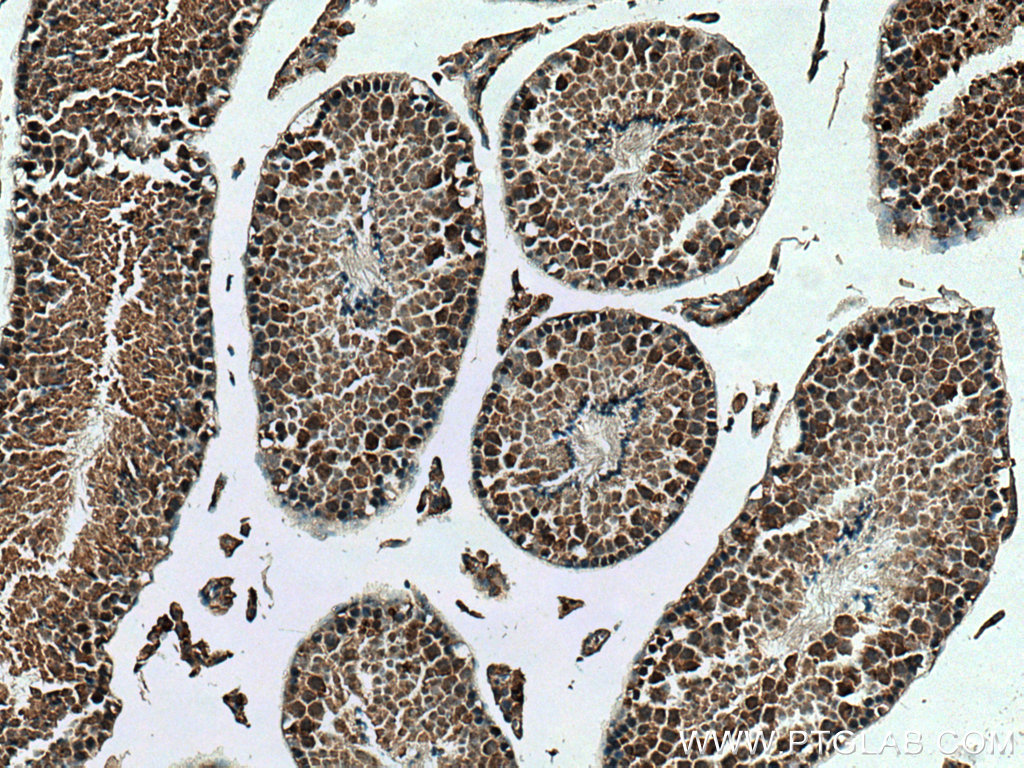 KIF2C Polyclonal antibody