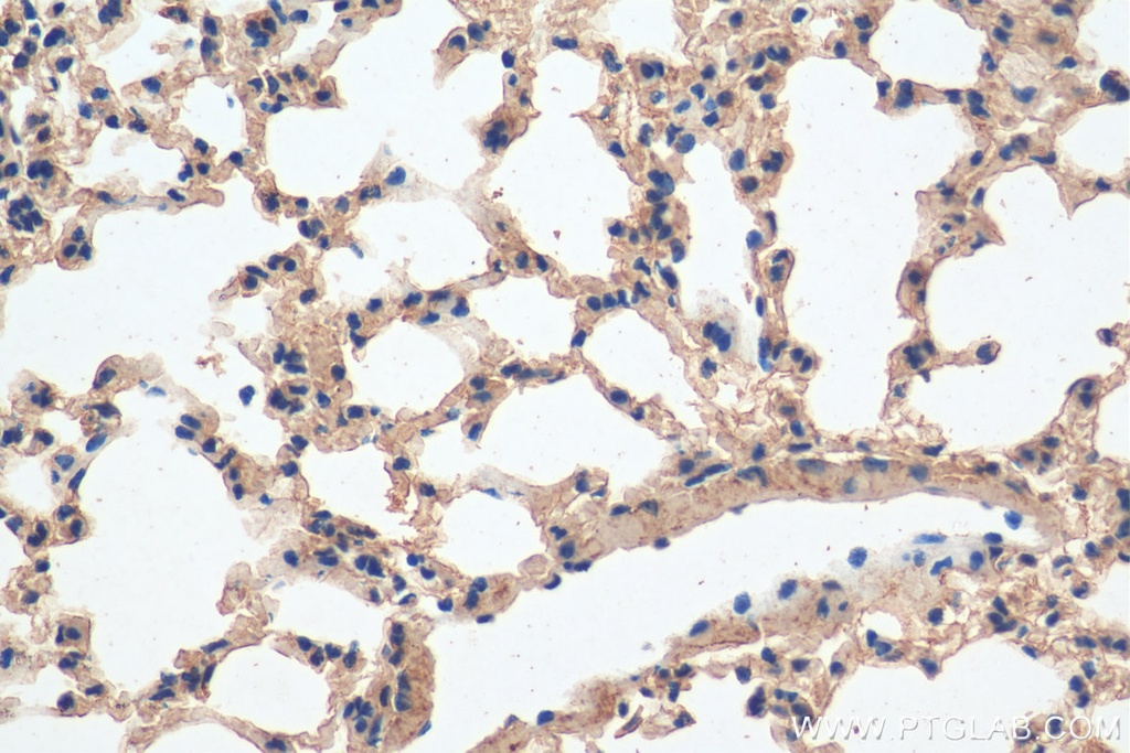 Integrin beta-6 Polyclonal antibody