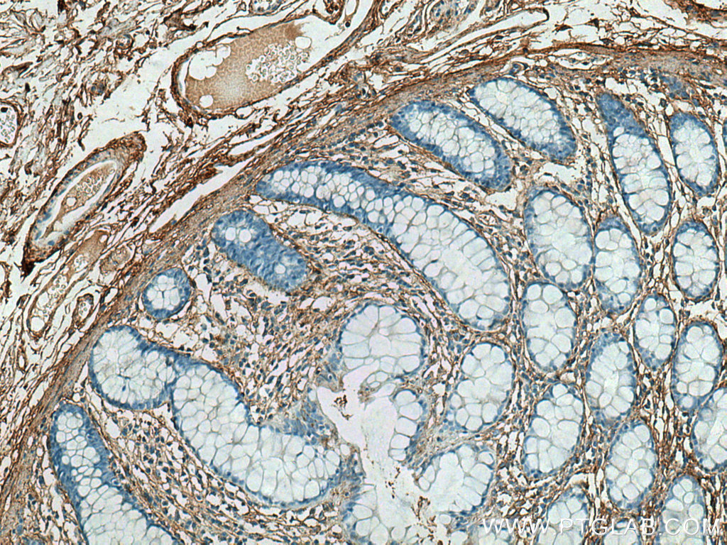 Collagen Type V Polyclonal antibody