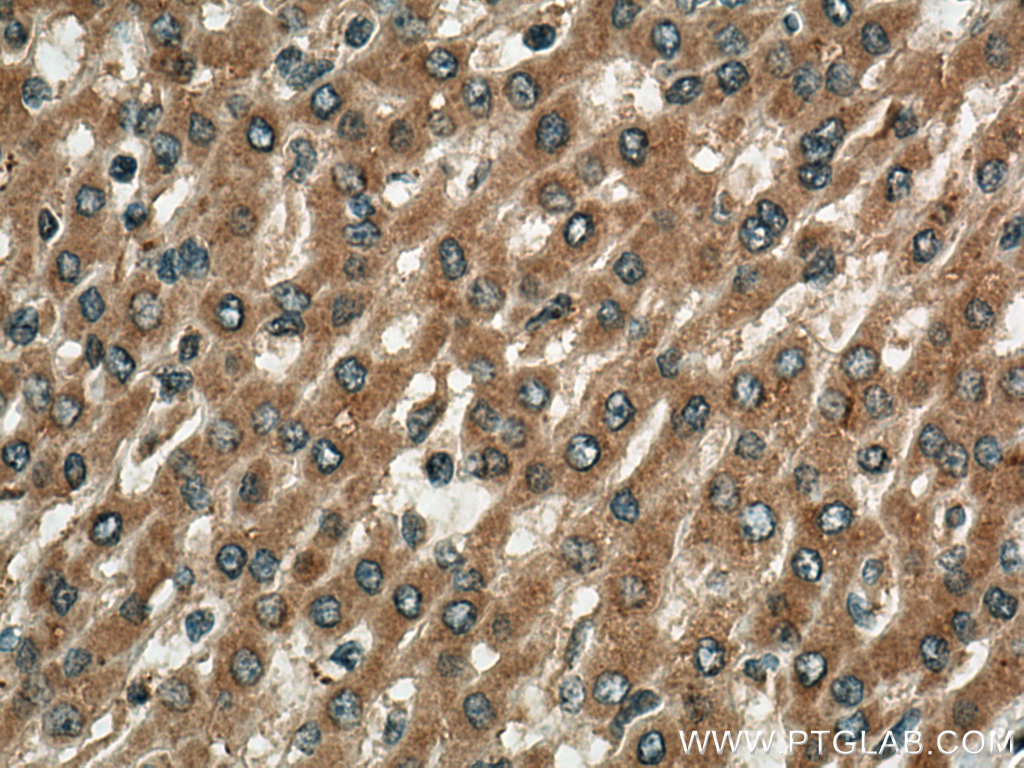TBK1 Polyclonal antibody