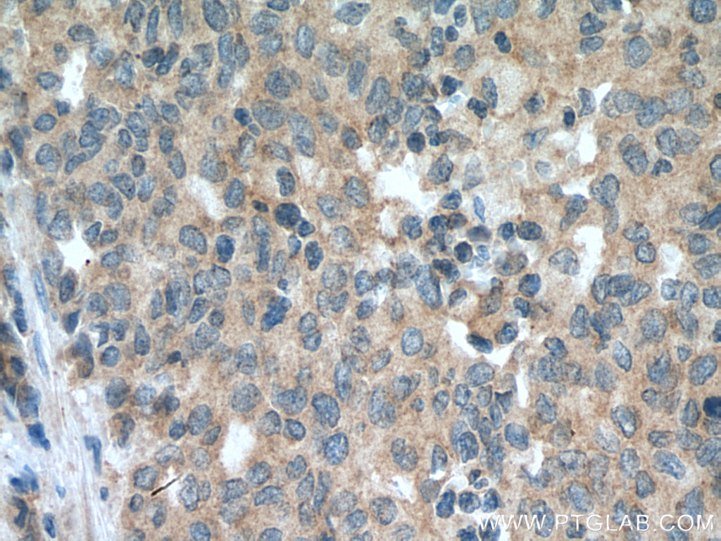SEMA4C Polyclonal antibody
