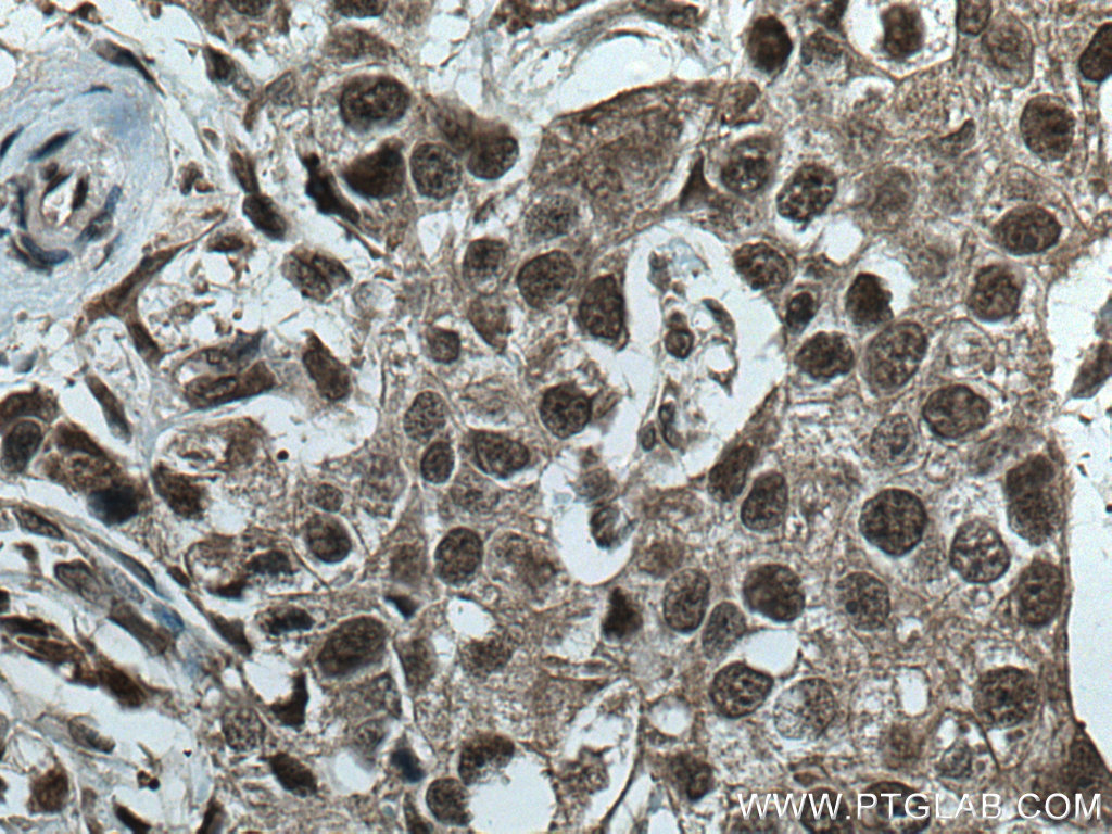 CUL1 Polyclonal antibody